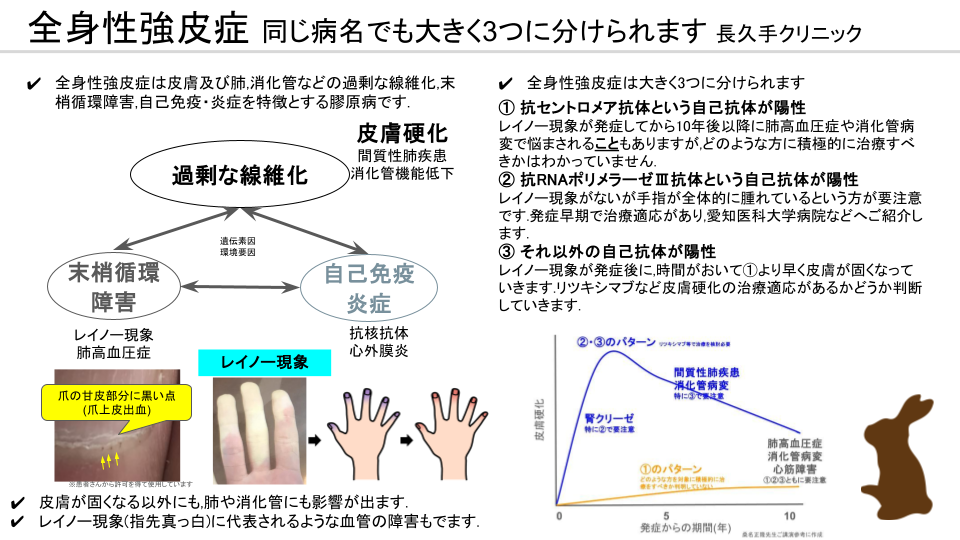 全身性強皮症(SSc) (1)