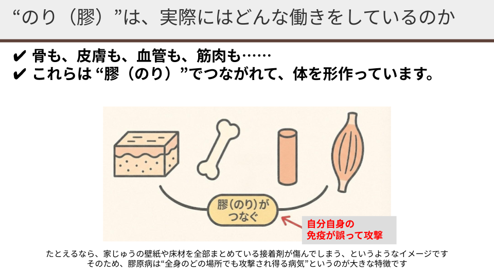 膠原病の解説図:皮膚・骨・血管をつなぐ組織(のり)が攻撃される