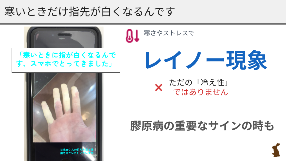 レイノー現象膠原病長久手クリニックブログ用.pptx
