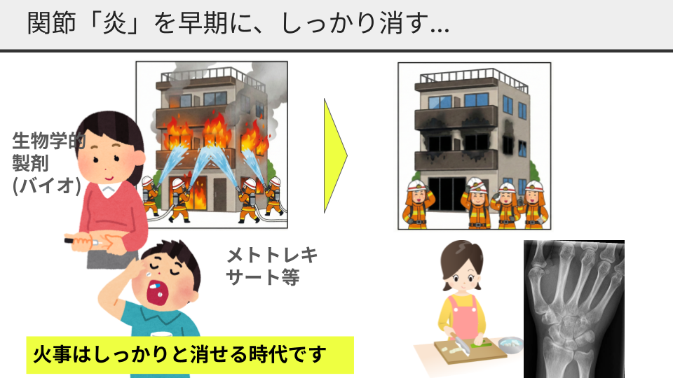 早期にしっかりと火（炎症）を消すことで、関節を守ることができます