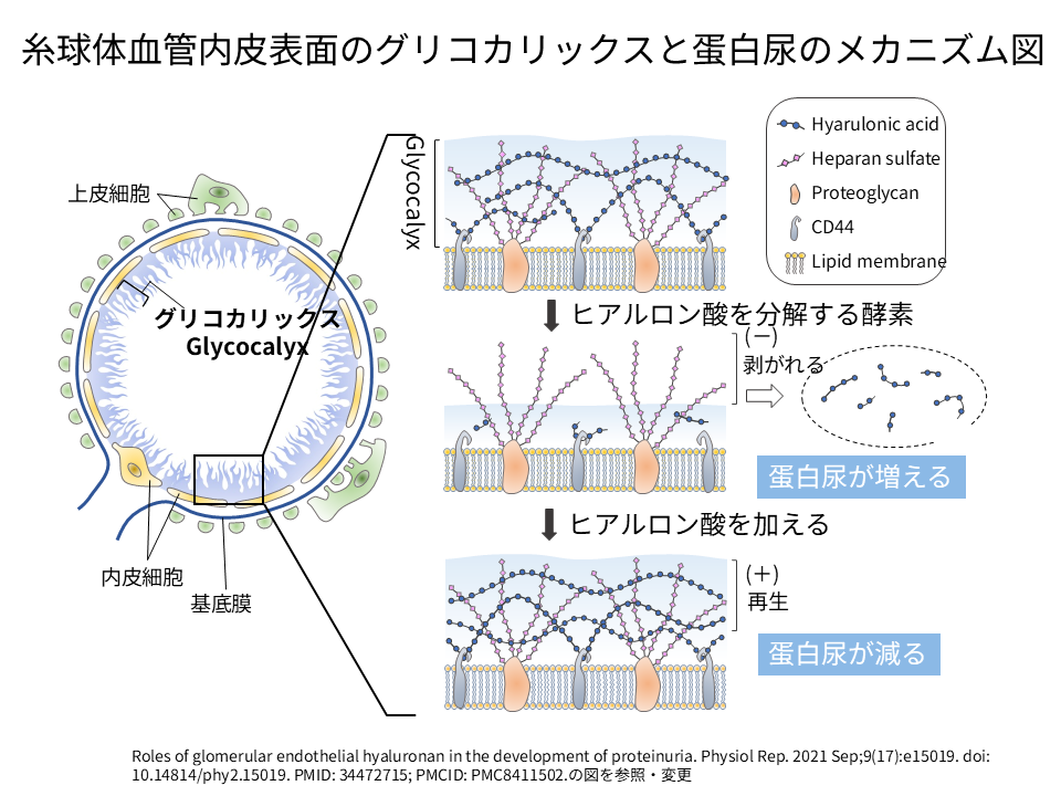 内皮バリアの損傷と蛋白尿発現のメカニズム図